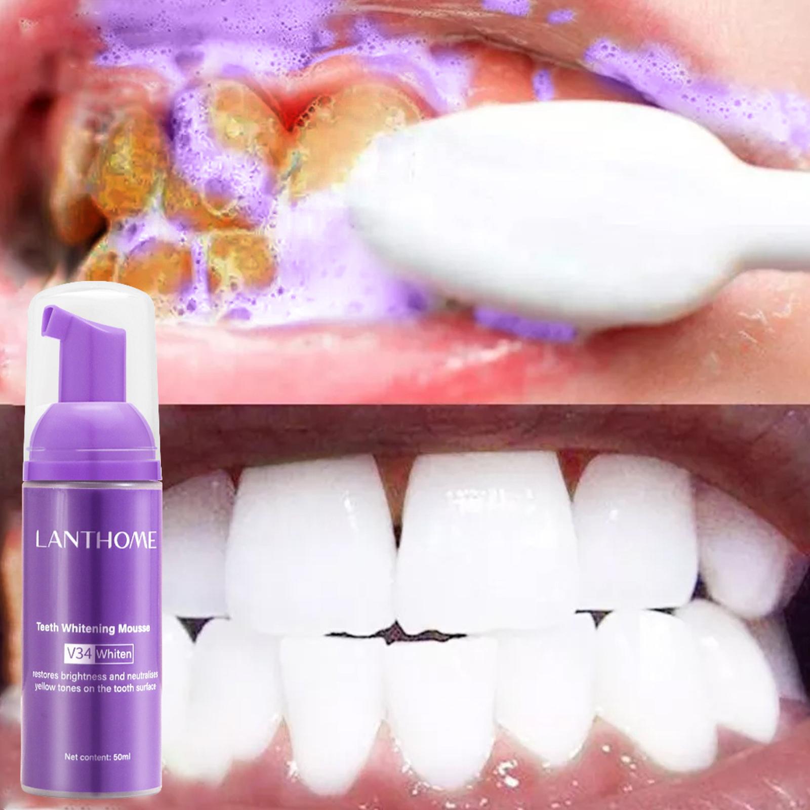 V34 Mousse Teeth Cleaning Toot - Teeth Whitening Yellow Teeth 评论和价格
