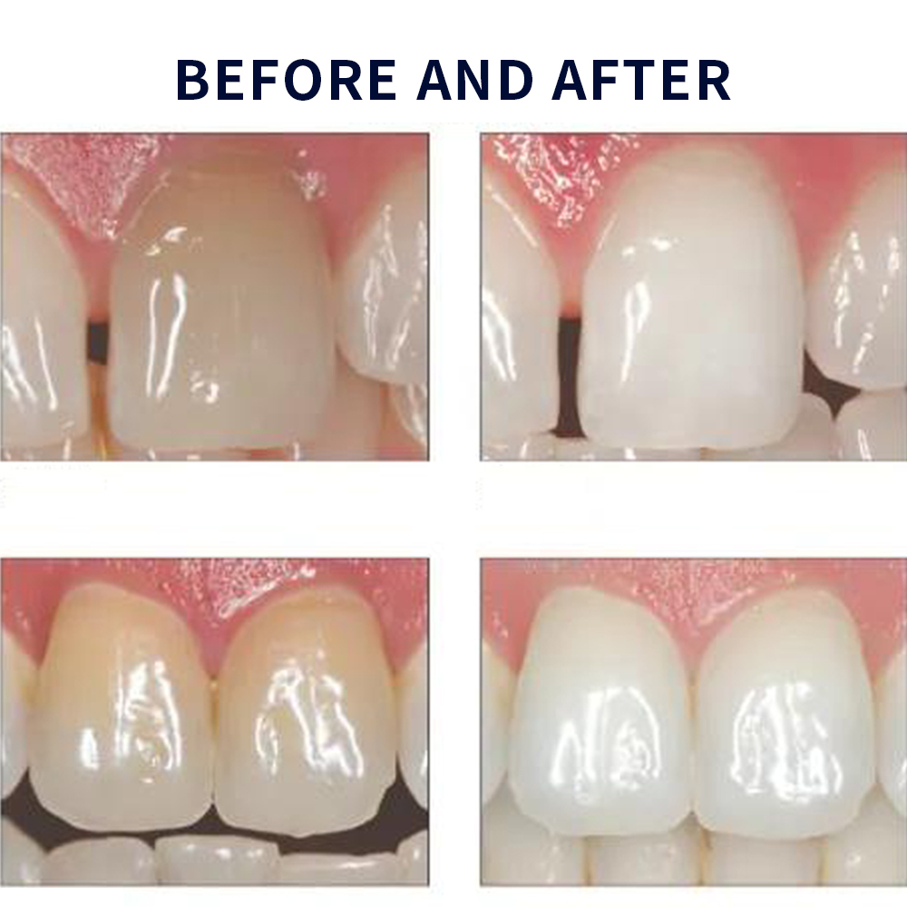 Opalescence Whitening 20% PF 2 - Teeth Whitening Ulta 评论和价格