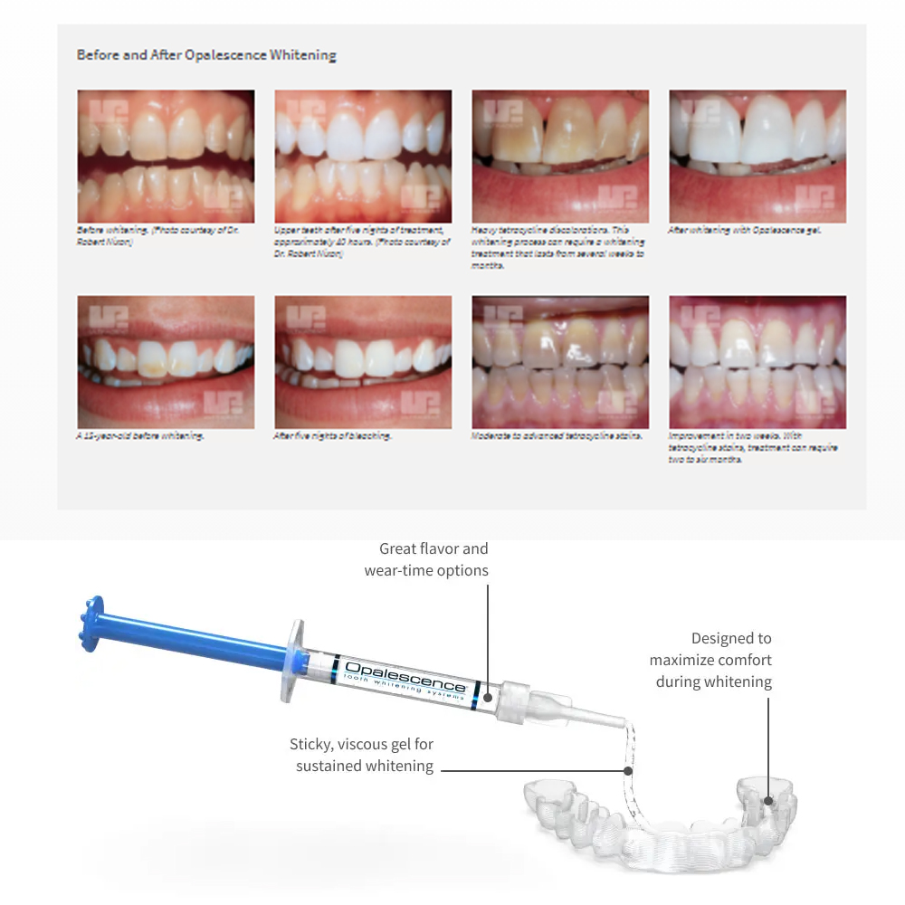 Opalescence Whitening 20% PF 2 - Teeth Whitening Ulta 评论和价格