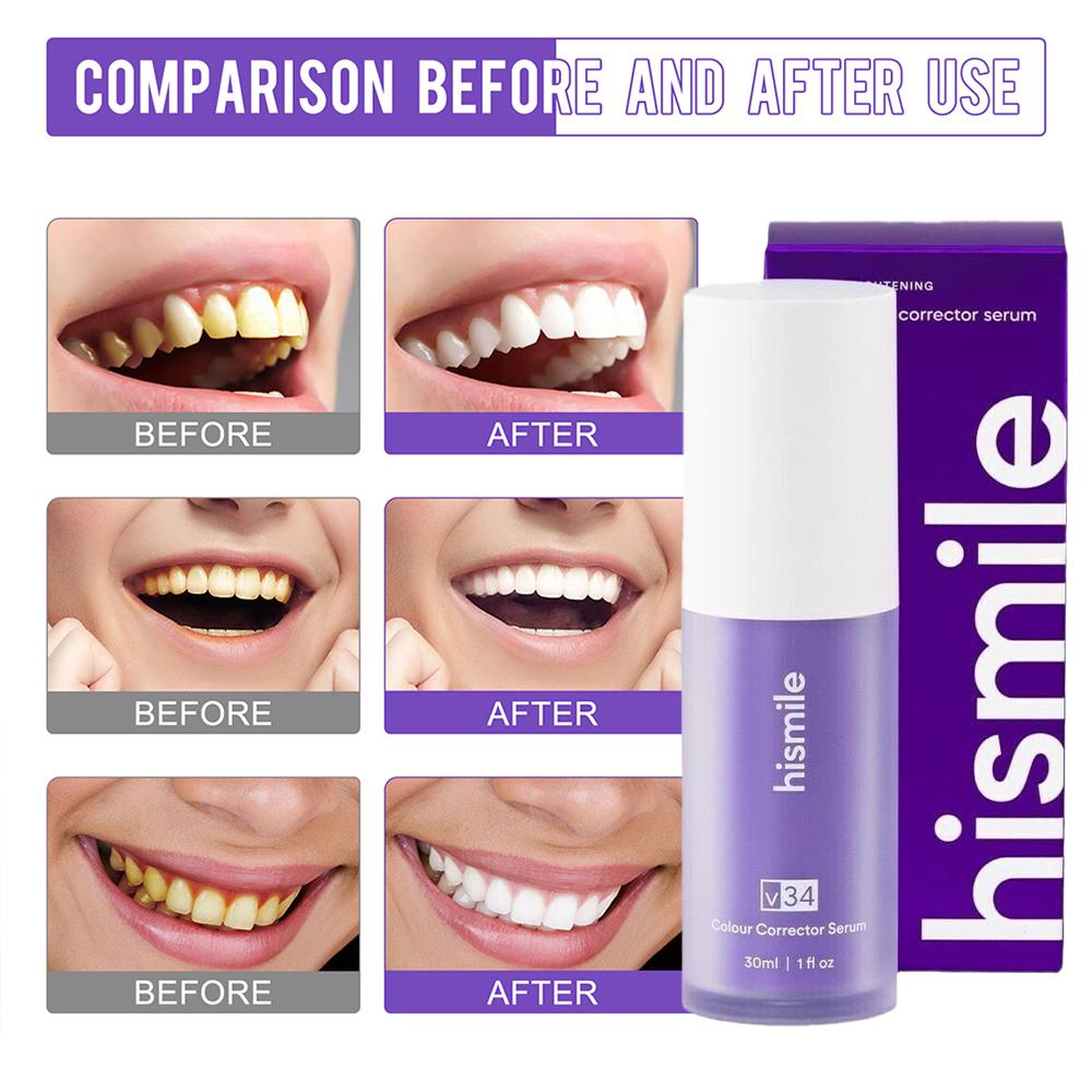 Purple Whitening Toothpaste De - Teeth Whitening Treatment 评论和价格